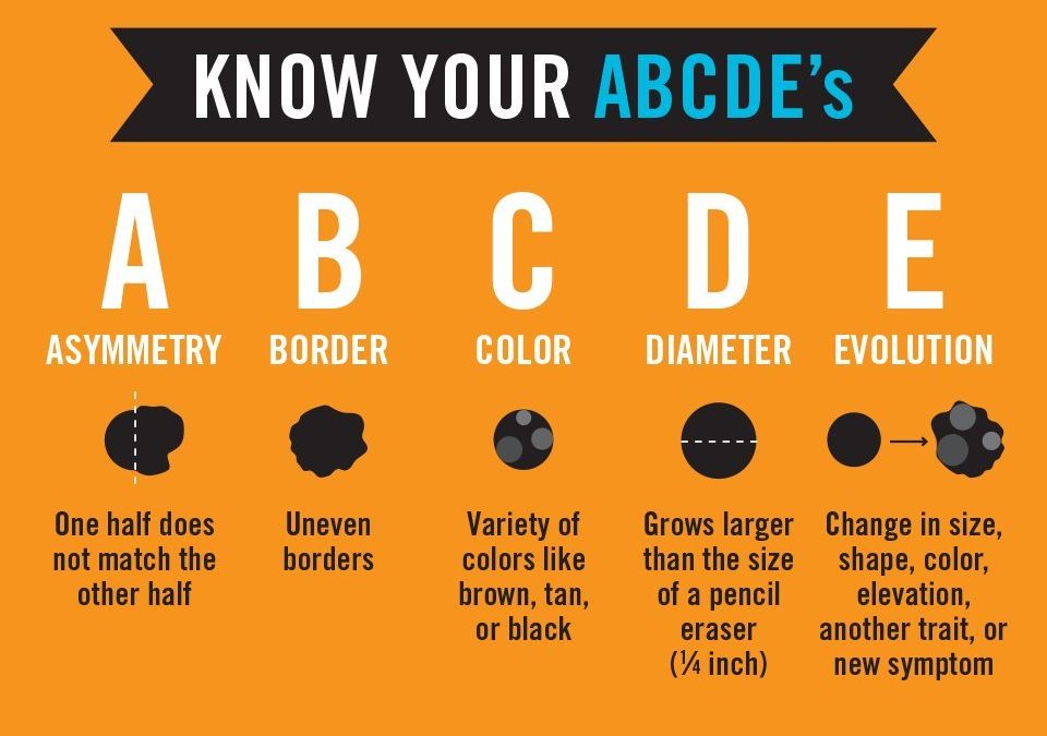 Chart of the different types of moles in alphabetical order