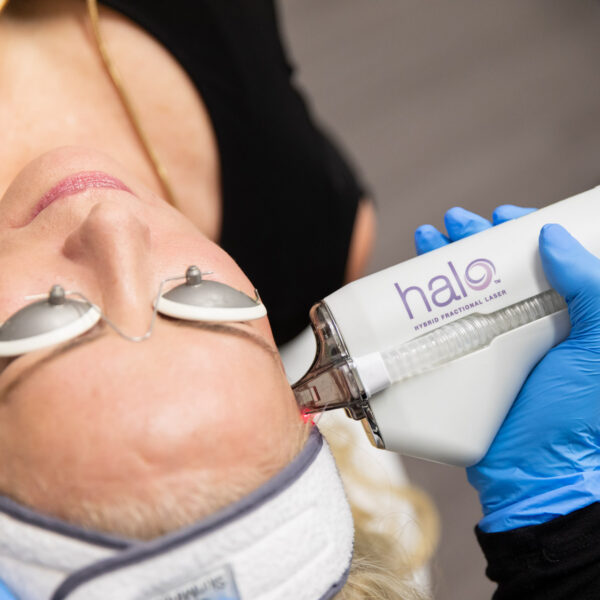 Halo Laser Treatment